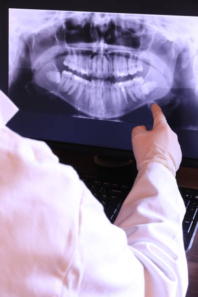 Best Dentist for Tooth Abscess  in Ohkay Owingeh, NM